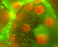 Fluorescence micrograph of cells showing orange-red nuclei and an intricate, bright green network of cellular extensions or cytoskeletal filaments.